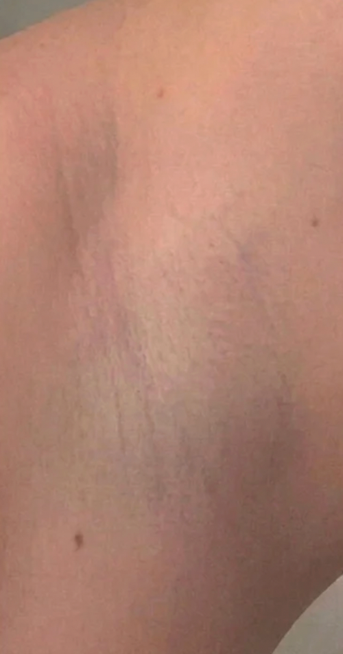 Dopo