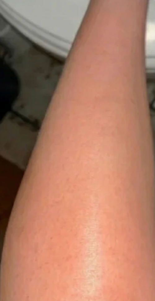 Dopo
